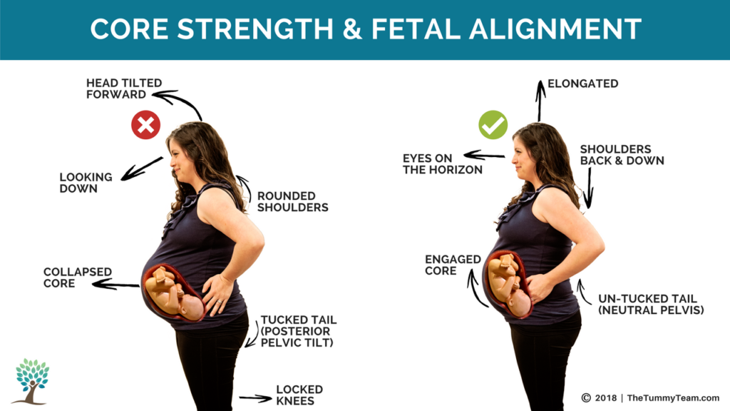 Posture Throughout Pregnancy Is Important