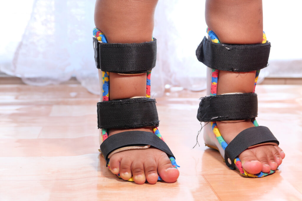 orthotics and bracing help kids